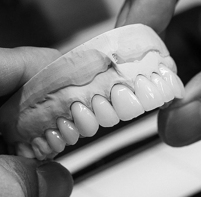 porcelain veneers panorama city